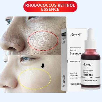 Сыворотка для лица с ретинолом Rhodococcus, сужающая поры, Подтягивающий кожу Увлажняющий крем, Осветляющий Корейские средства по уходу за кожей 30 мл